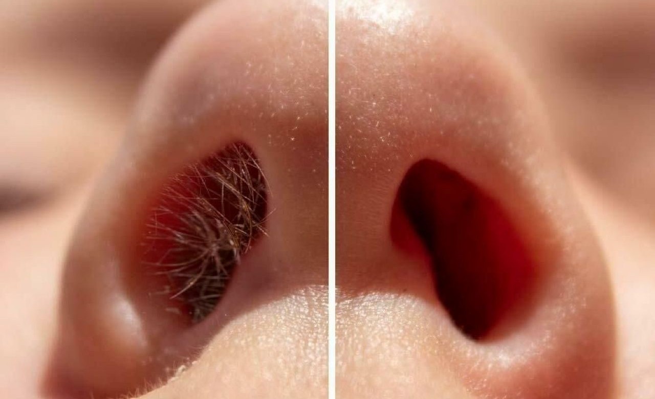 nose-wax